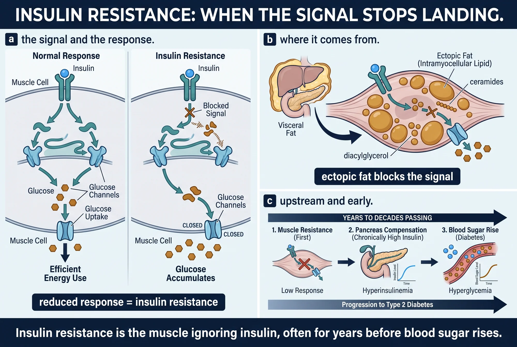 Scientific plate titled 'insulin resistance', in three panels. Panel a: insulin binding weakly to a skeletal-muscle cell, so glucose stays in the bloodstream rather than entering the cell. Panel b: droplets of fat stored inside the muscle and liver cells, together with visceral fat around the abdominal organs, interfering with the insulin signal. Panel c: a timeline in which muscle insulin resistance and compensatory high insulin appear years to decades before blood glucose finally rises.